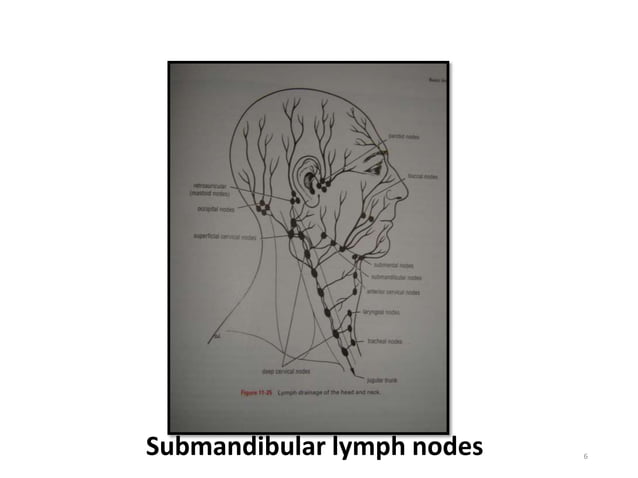 Management of ca maxillary sinus | PPTX | Ear, Nose and Throat ...