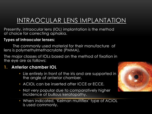 management-of-cataract-ppt