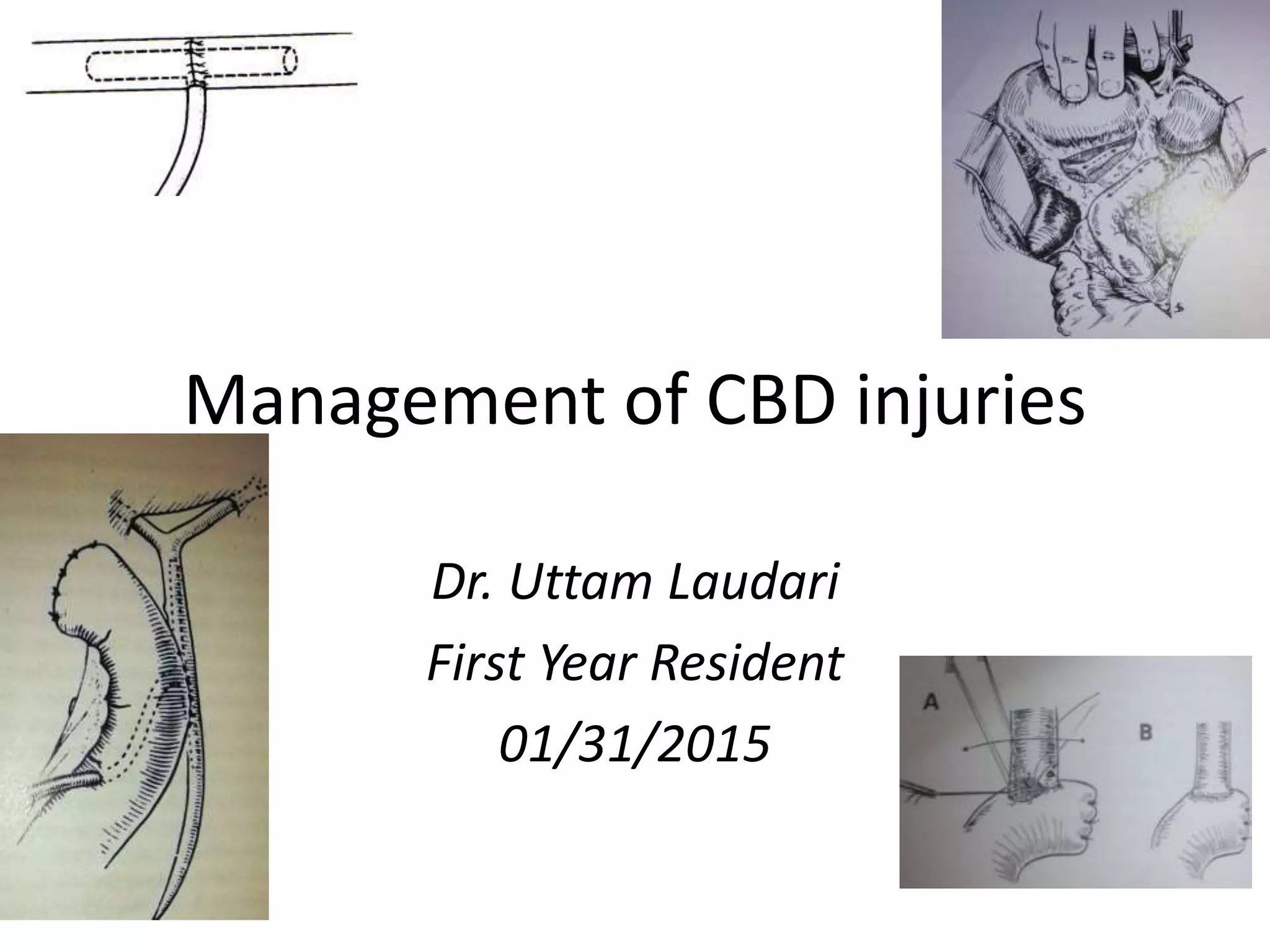 Management Of Common Bile Duct Injuries Pptx Management Of Common Bile Duct Injuries Pptx