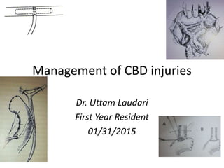 Management of Common bile duct injuries | PPTX