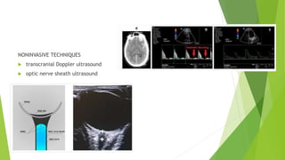 Management of Cerebral edema 1 [Autosaved].pptx