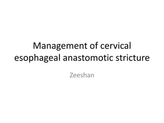 Management of cervical
esophageal anastomotic stricture
Zeeshan
 