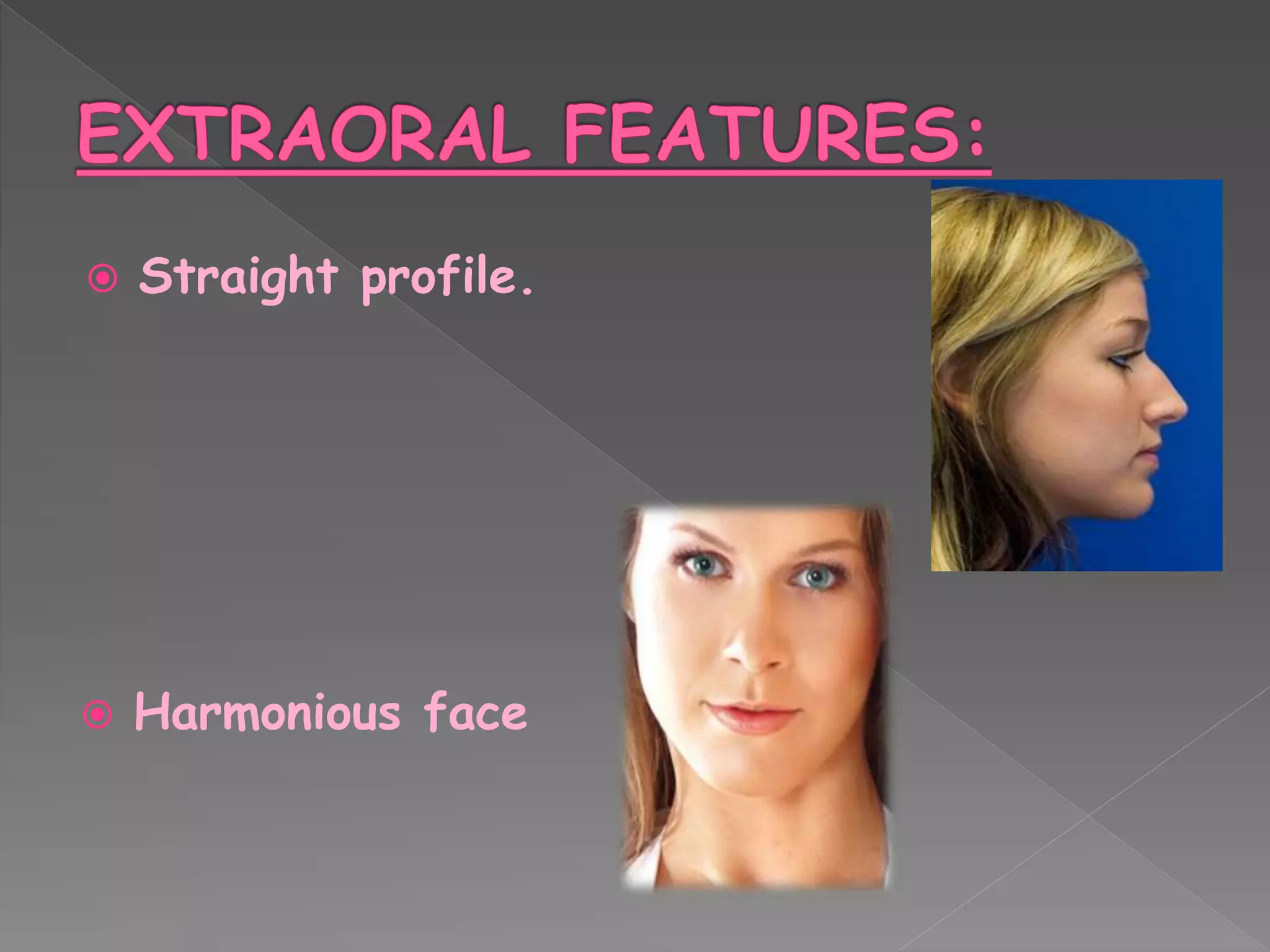  Straight profile.
 Harmonious face
 