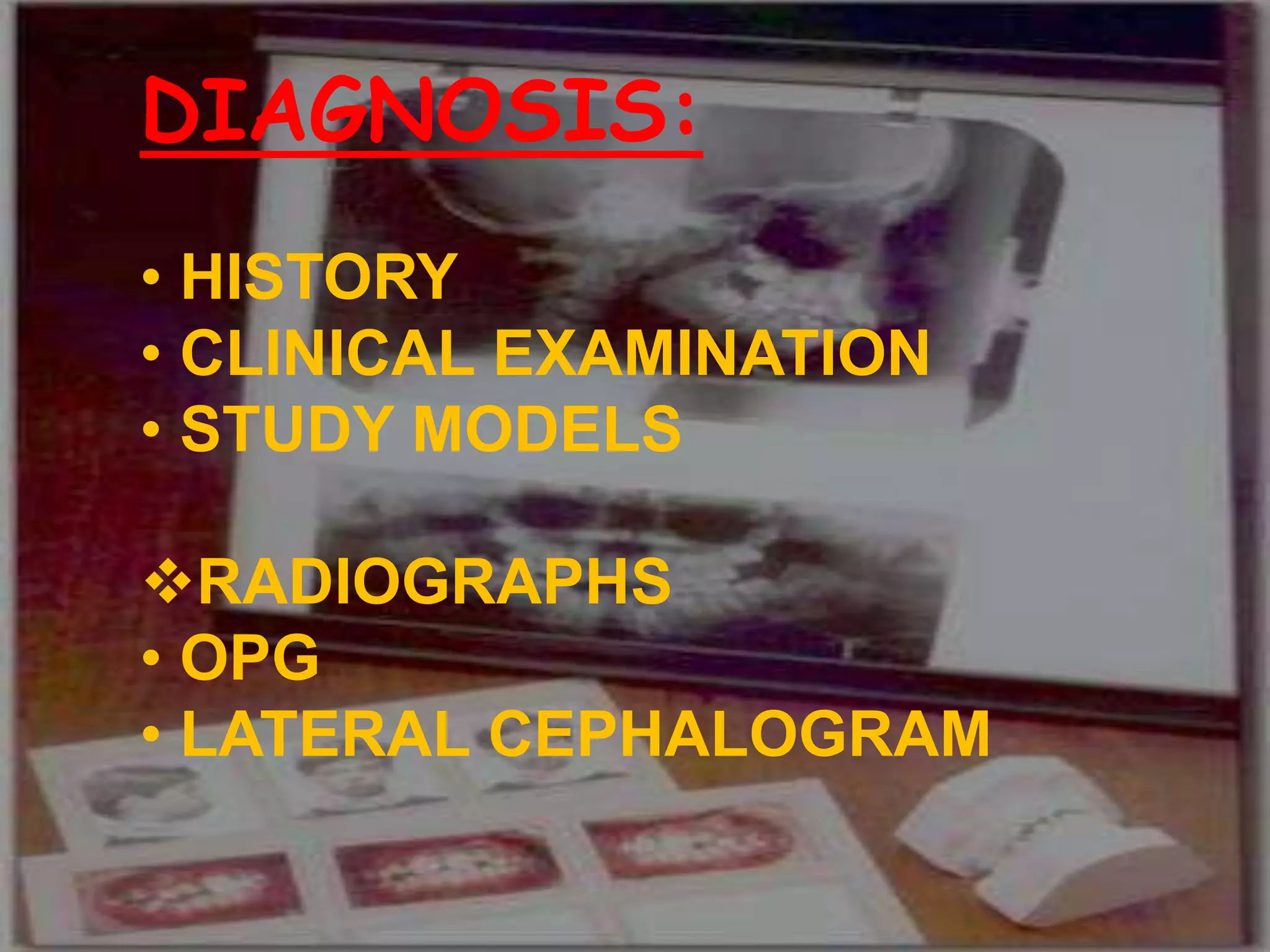 • HISTORY
• CLINICAL EXAMINATION
• STUDY MODELS
RADIOGRAPHS:
• OPG
• LATERAL CEPHALOGRAM
DIAGNOSIS:
• HISTORY
• CLINICAL EXAMINATION
• STUDY MODELS
RADIOGRAPHS
• OPG
• LATERAL CEPHALOGRAM
 