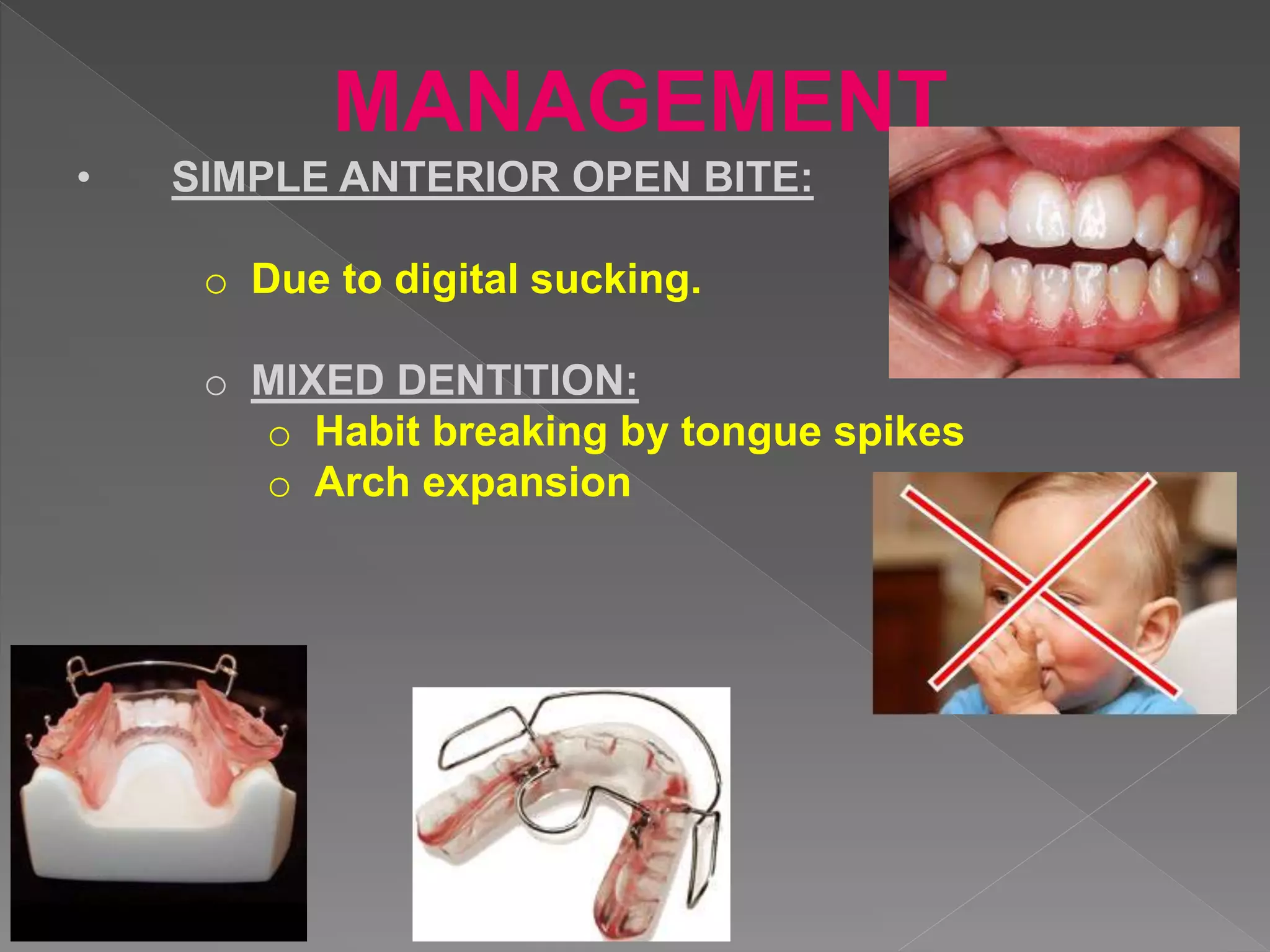 MANAGEMENT
• SIMPLE ANTERIOR OPEN BITE:
o Due to digital sucking.
o MIXED DENTITION:
o Habit breaking by tongue spikes
o Arch expansion
 