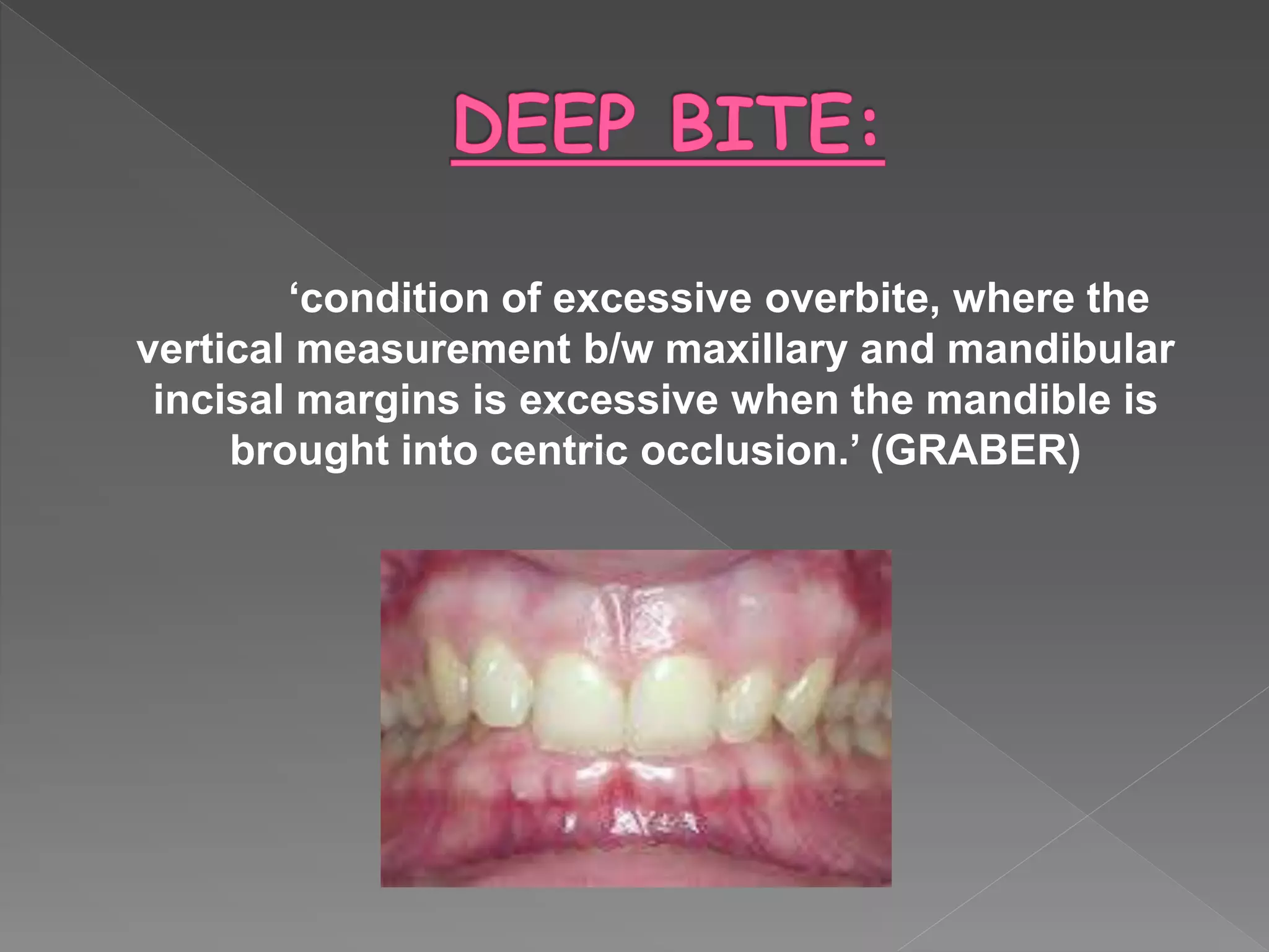 ‘condition of excessive overbite, where the
vertical measurement b/w maxillary and mandibular
incisal margins is excessive when the mandible is
brought into centric occlusion.’ (GRABER)
 