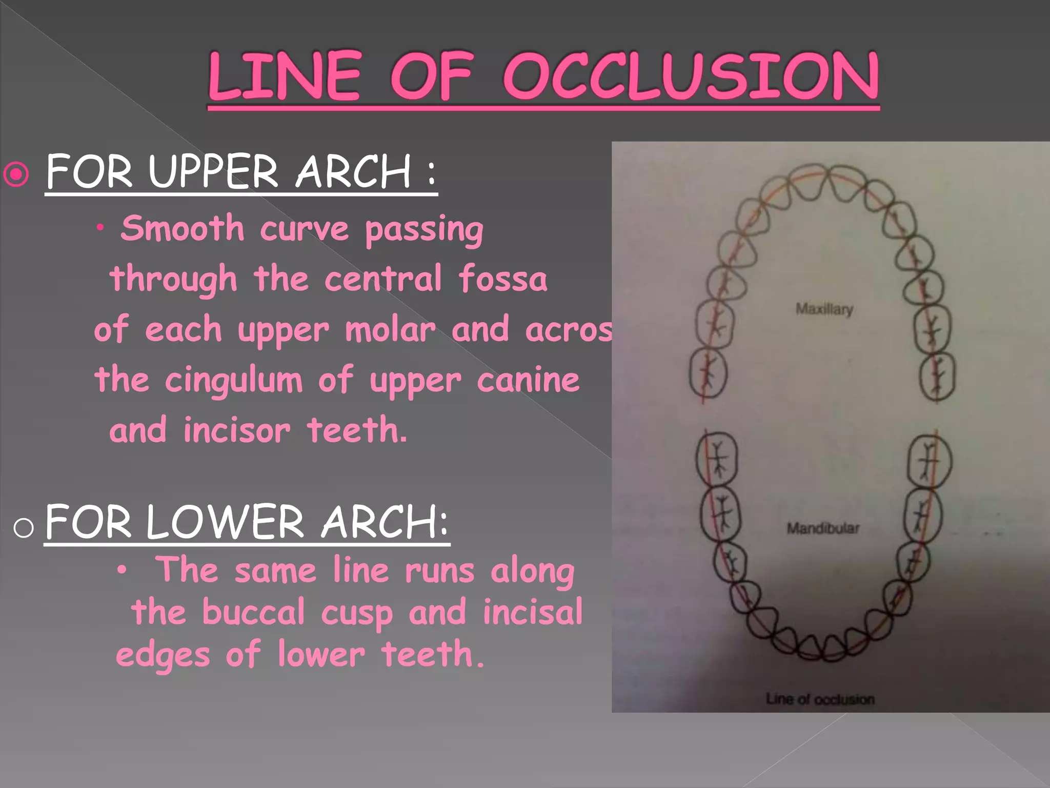  FOR UPPER ARCH :
 Smooth curve passing
through the central fossa
of each upper molar and across
the cingulum of upper canine
and incisor teeth.
o FOR LOWER ARCH:
• The same line runs along
the buccal cusp and incisal
edges of lower teeth.
 