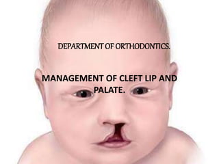MANAGEMENT OF CLEFT LIP AND
PALATE.
DEPARTMENT OF ORTHODONTICS.
 