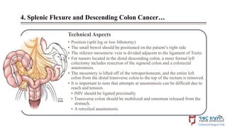 Management of colon cancer(surgical).pptx
