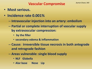 Extravascular Injection Management of complications of dermal fillers implant | PPTX