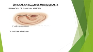 MANAGEMENT OF CSOM. Surgery cmom cholesteatoma | PPTX
