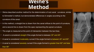 MANAGEMENT OF CURVED CANALS IN ENDODONTICS.pptx