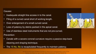 MANAGEMENT OF CURVED CANALS IN ENDODONTICS.pptx