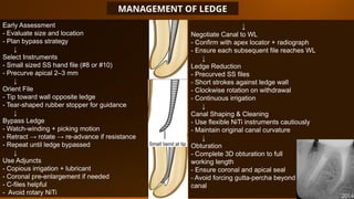 Ledge Radiograph MANAGEMENT OF CURVED CANALS IN ENDODONTICS.pptx