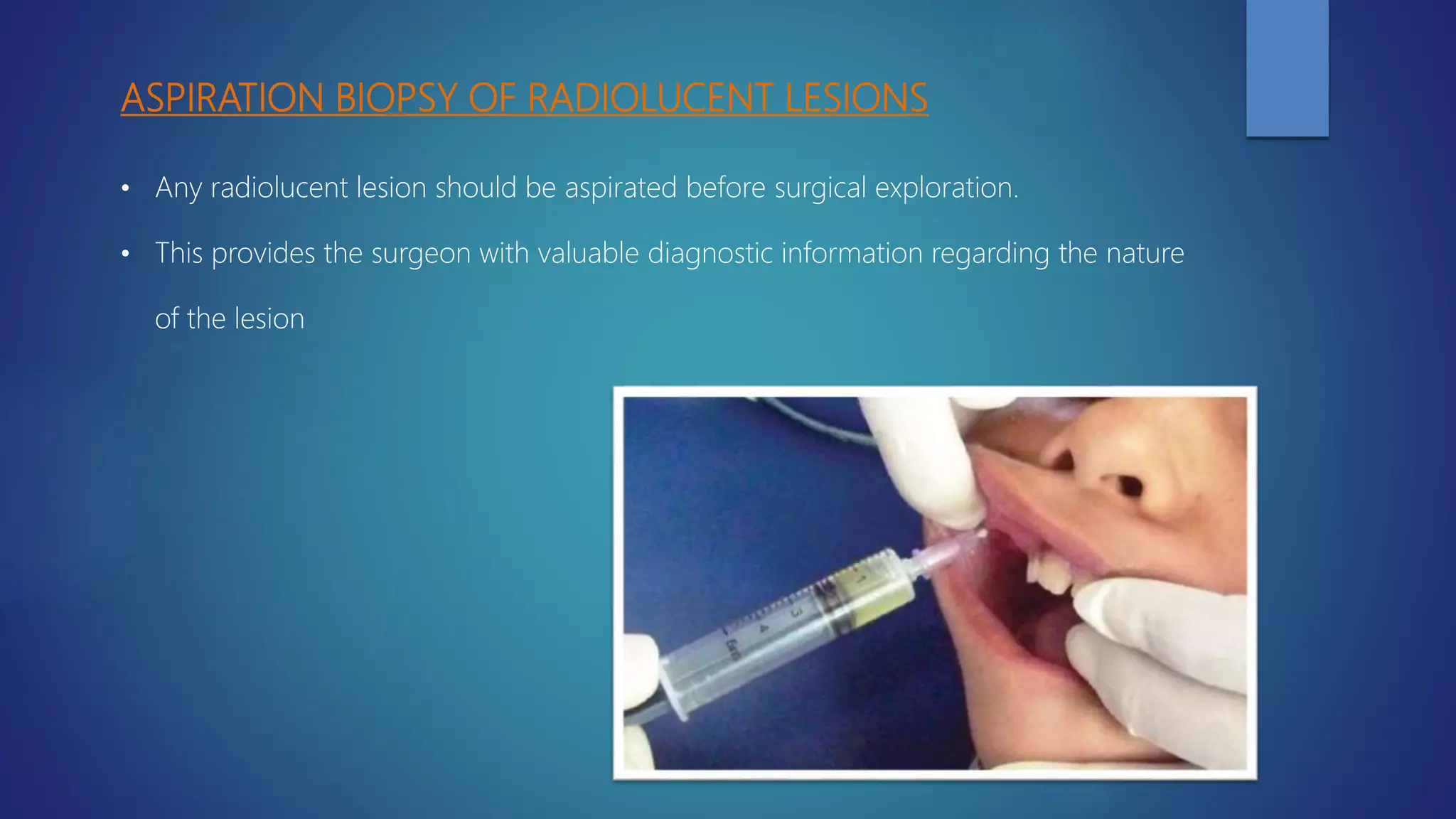 Management of cyst | PPTX