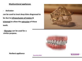 Fixed appliances

  1) Use of anchorage bends:

    given in the arch wire mesial to the
    molar tubes (the anterior par...