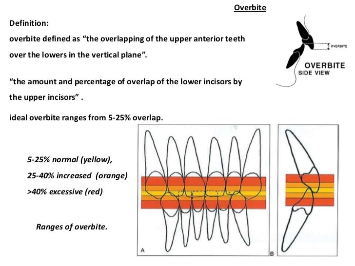 Management of Deep Bite _ Dr. Nabil AlZubair