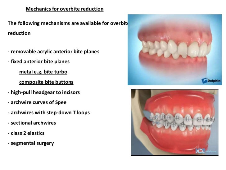 nabil zubair elastics