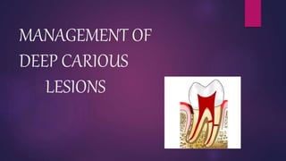MANAGEMENT OF
DEEP CARIOUS
LESIONS
 