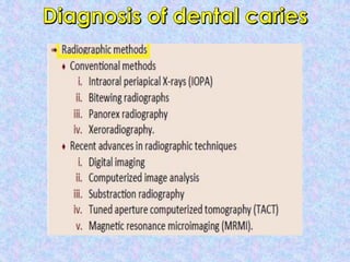 Management of dental caries | PDF