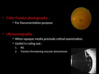 Traction Rd Fundus Management of Diabetic Retinopathy - DR SHAlini.pptx