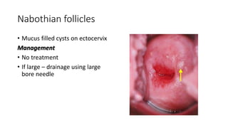 Management of diseases of cervix | PPTX