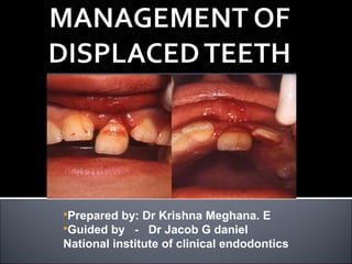 Prepared by: Dr Krishna Meghana. E
Guided by - Dr Jacob G daniel
National institute of clinical endodontics
 