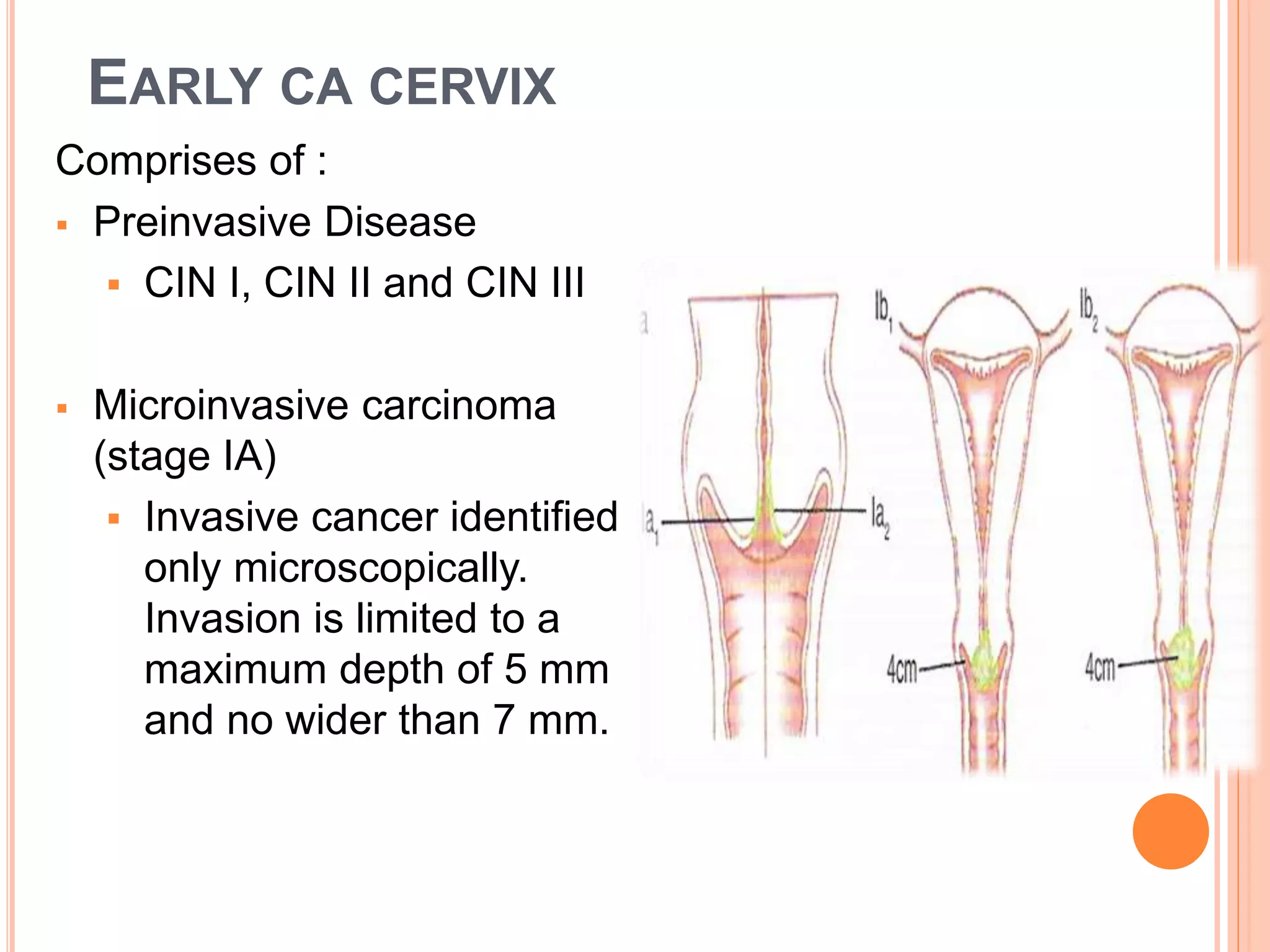 Management of Early Stage Carcinoma Cervix | PPTX