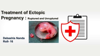Debashis Nanda
Roll- 16
Treatment of Ectopic
Pregnancy : Ruptured and Unruptured
 
