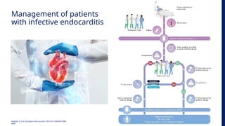 Management of Endocarditis_2023 ESC Guidelines.pptx