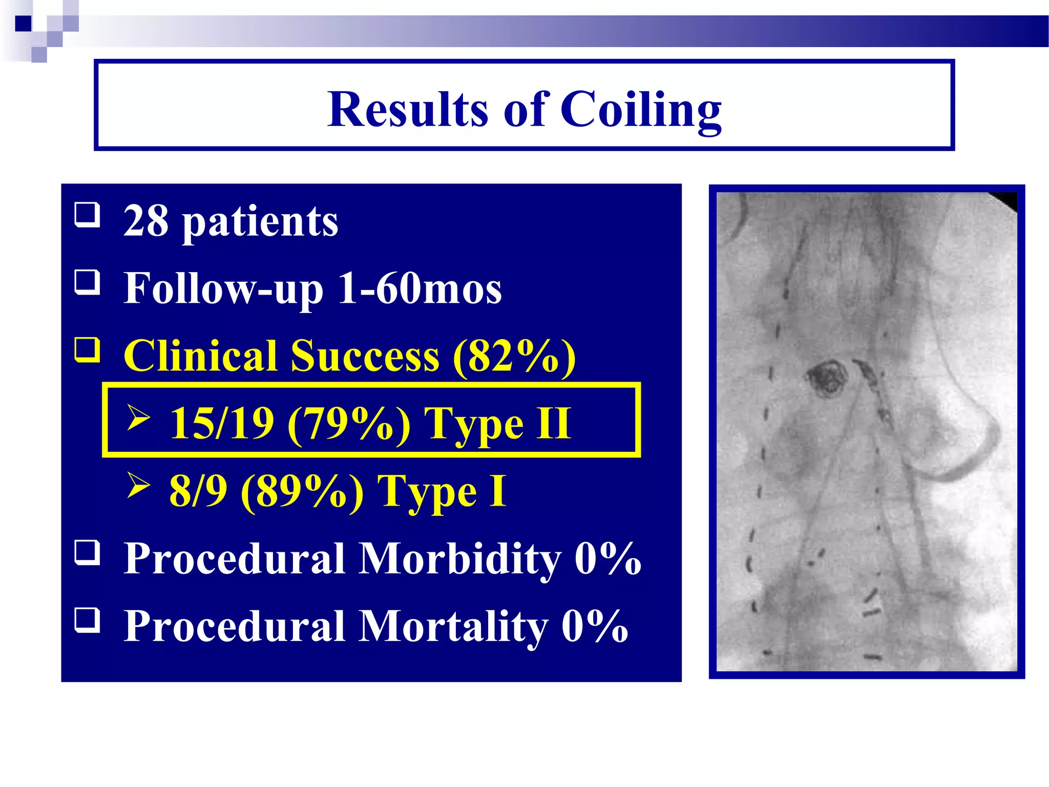 Results of Coiling
 28 patients
 Follow-up 1-60mos
 Clinical Success (82%)
 15/19 (79%) Type II
 8/9 (89%) Type I
 Procedural Morbidity 0%
 Procedural Mortality 0%
 