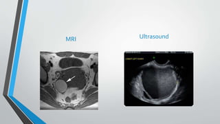 MRI Ultrasound
 