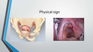 Physical sign
 