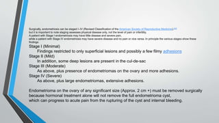 Surgically, endometriosis can be staged I–IV (Revised Classification of the American Society of Reproductive Medicine).[42]
but it is important to note staging assesses physical disease only, not the level of pain or infertility.
A patient with Stage I endometriosis may have little disease and severe pain,
while a patient with Stage IV endometriosis may have severe disease and no pain or vice versa. In principle the various stages show these
findings:
Stage I (Minimal)
Findings restricted to only superficial lesions and possibly a few filmy adhesions
Stage II (Mild)
In addition, some deep lesions are present in the cul-de-sac
Stage III (Moderate)
As above, plus presence of endometriomas on the ovary and more adhesions.
Stage IV (Severe)
As above, plus large endometriomas, extensive adhesions.
Endometrioma on the ovary of any significant size (Approx. 2 cm +) must be removed surgically
because hormonal treatment alone will not remove the full endometrioma cyst,
which can progress to acute pain from the rupturing of the cyst and internal bleeding.
 