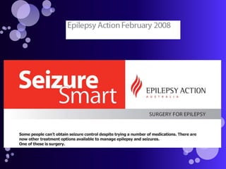 Management of epilepsy | PPTX