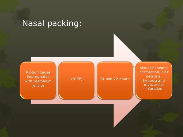 Management of epistaxis