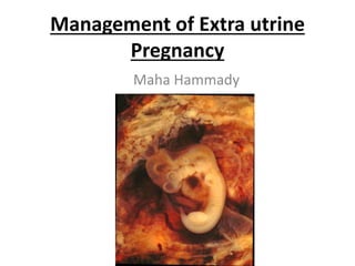 Management of Extra utrine
Pregnancy
Maha Hammady
 