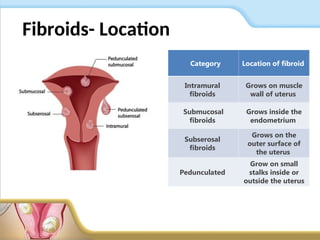 Management of Fibroids slide deck.pptmmmmmmkk | PPT