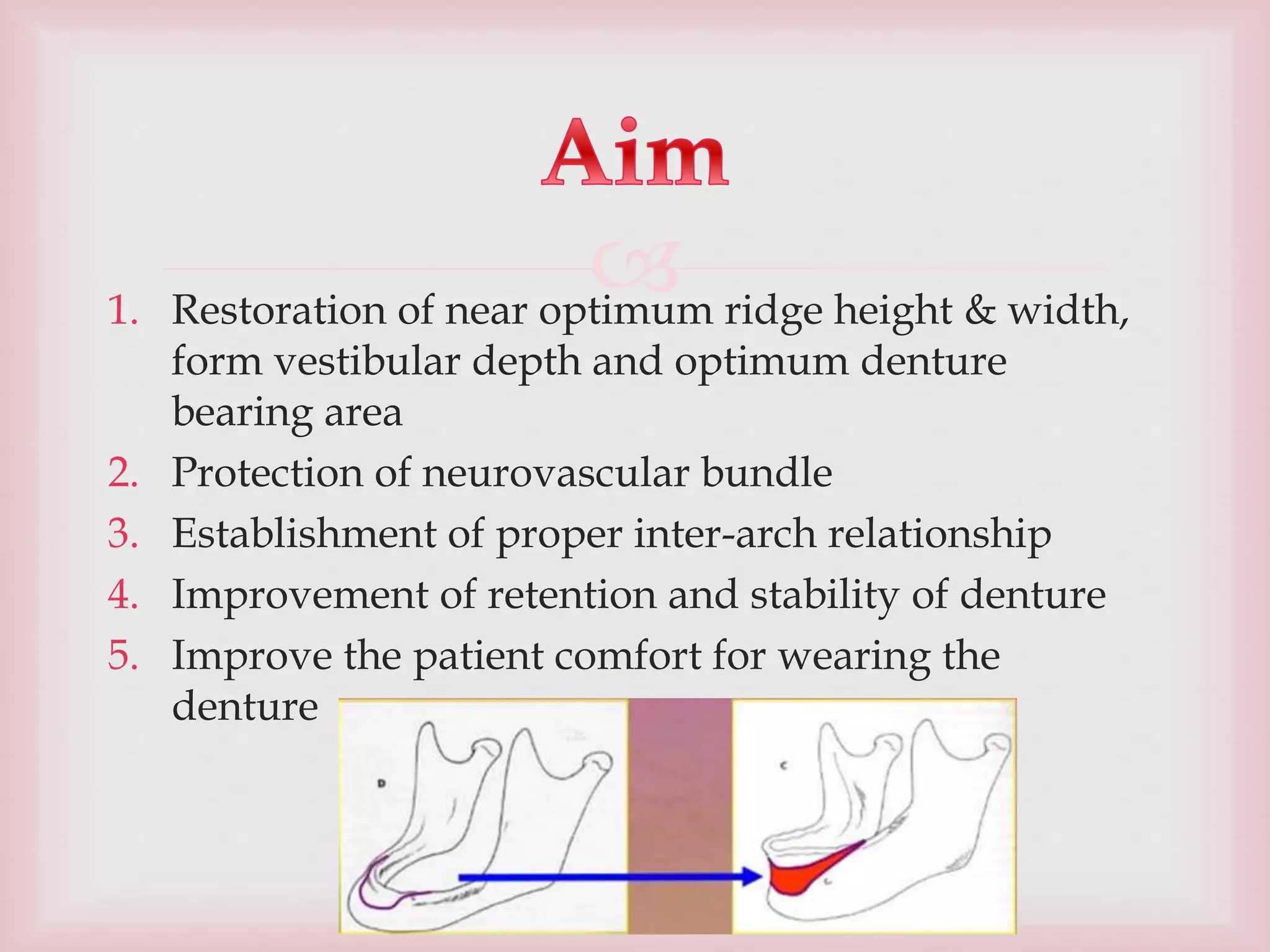 flat ridge management .pptx