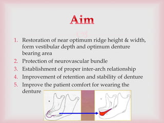 
1. Restoration of near optimum ridge height & width,
form vestibular depth and optimum denture
bearing area
2. Protection of neurovascular bundle
3. Establishment of proper inter-arch relationship
4. Improvement of retention and stability of denture
5. Improve the patient comfort for wearing the
denture
 