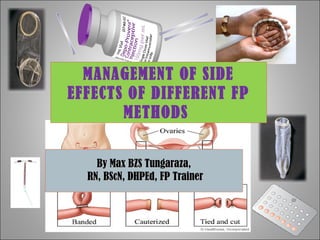 MANAGEMENT OF SIDE
EFFECTS OF DIFFERENT FP
METHODS
By Max BZS Tungaraza,By Max BZS Tungaraza,
RN, BScN, DHPEd, FP TrainerRN, BScN, DHPEd, FP Trainer
 