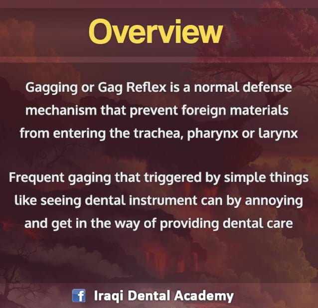 Management of Gag Reflex