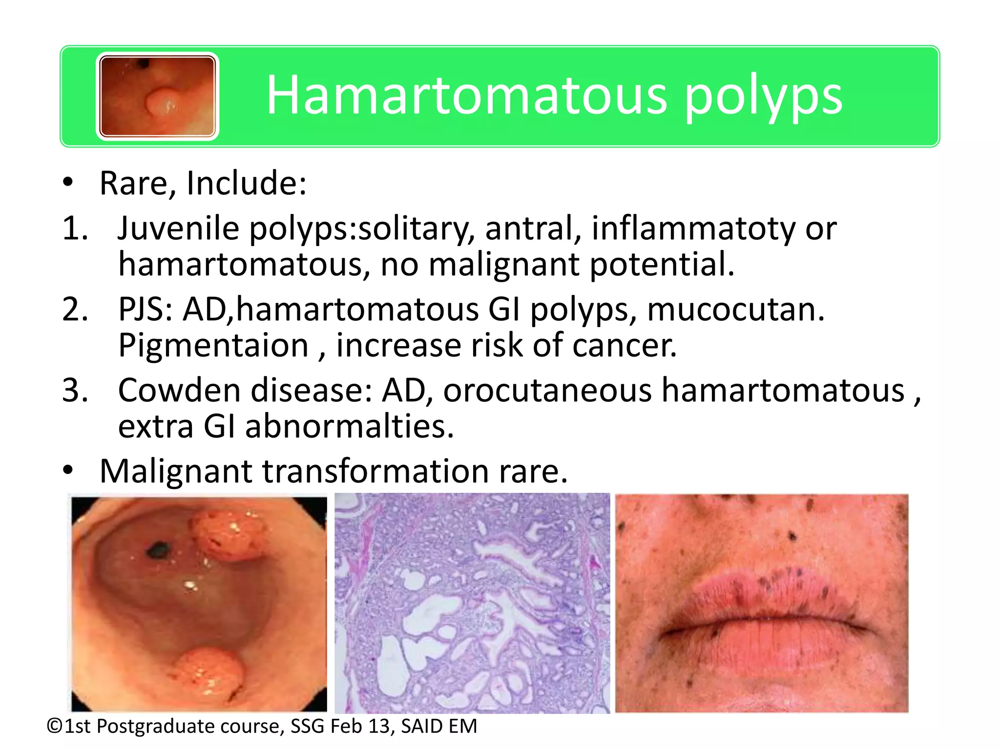 Hamartomatous polyps 
• Rare, Include: 
1. Juvenile polyps:solitary, antral, inflammatoty or 
hamartomatous, no malignant potential. 
2. PJS: AD,hamartomatous GI polyps, mucocutan. 
Pigmentaion , increase risk of cancer. 
3. Cowden disease: AD, orocutaneous hamartomatous , 
extra GI abnormalties. 
• Malignant transformation rare. 
©1st Postgraduate course, SSG Feb 13, SAID EM 
 