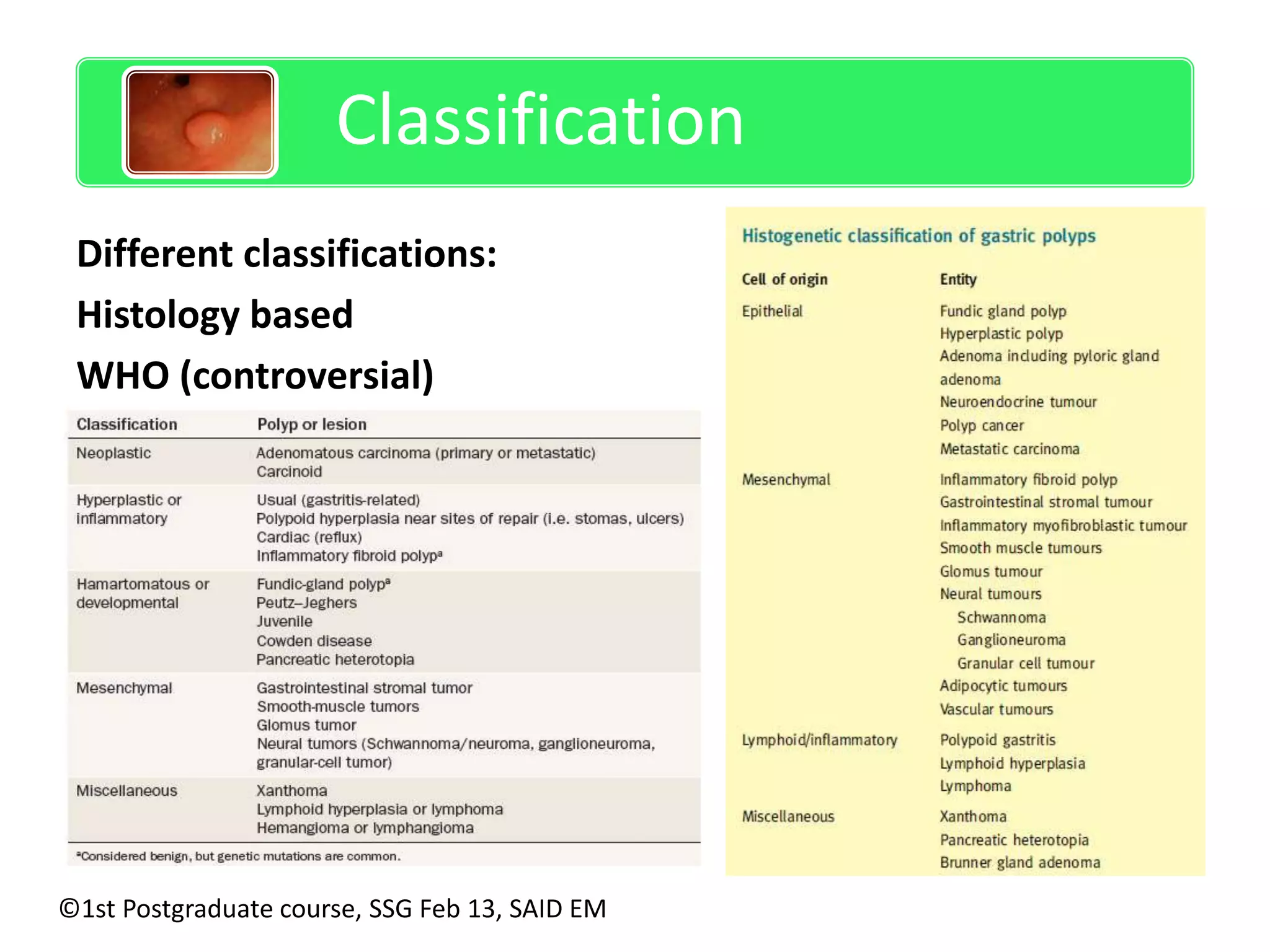 Classification 
Different classifications: 
Histology based 
WHO (controversial) 
©1st Postgraduate course, SSG Feb 13, SAID EM 
 