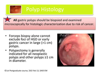 Management of gastric polyps | PPTX