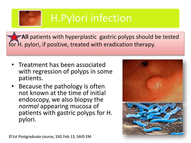 Management of gastric polyps | PPTX