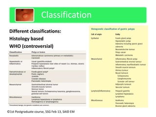 Management of gastric polyps | PPTX