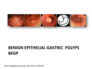 Management of gastric polyps | PPTX