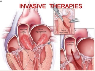INVASIVE THERAPIES
 