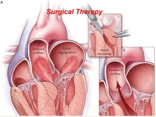 Surgical Therapy
 